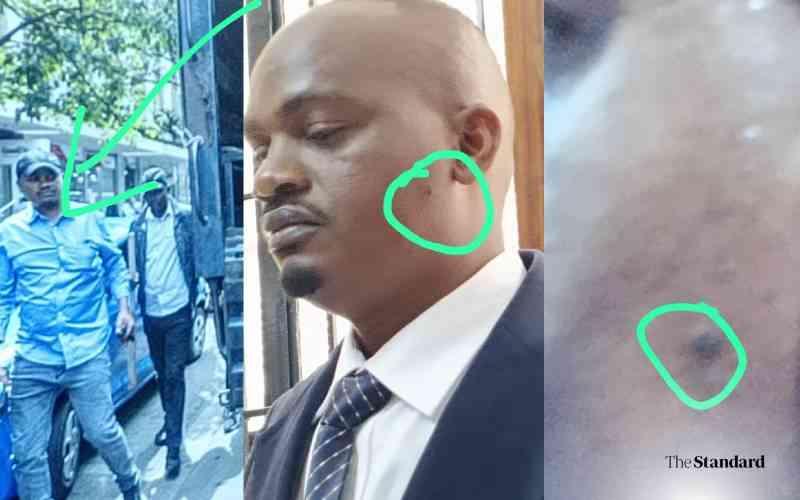 Officer Denies Role in Rex Masai Killing Despite Photos