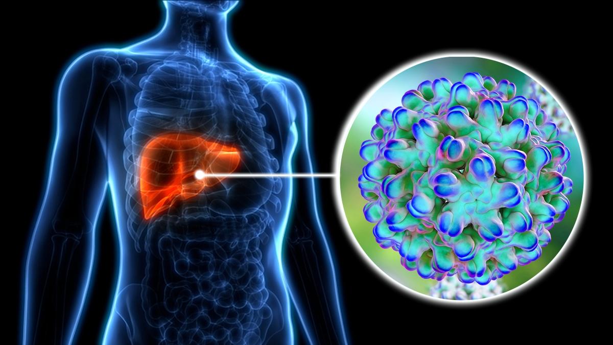 WHO Labels Hepatitis D a Cancer Risk, Urges Global Action